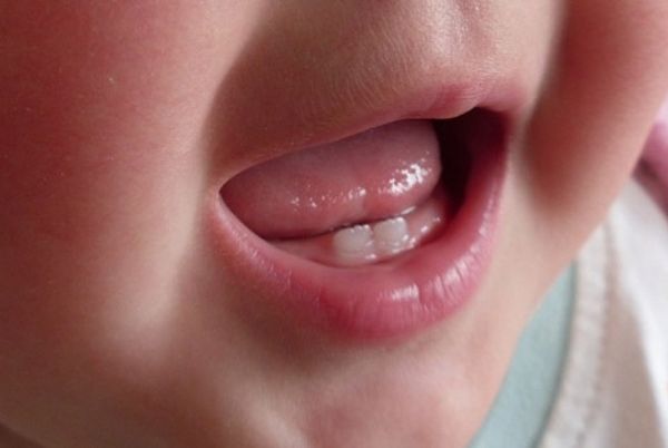 Yey Gigi Pertama Tumbuh, Gini Cara Rawatnya